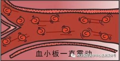 血小板是正常值的三倍？專(zhuān)家提醒小心血栓和出血！