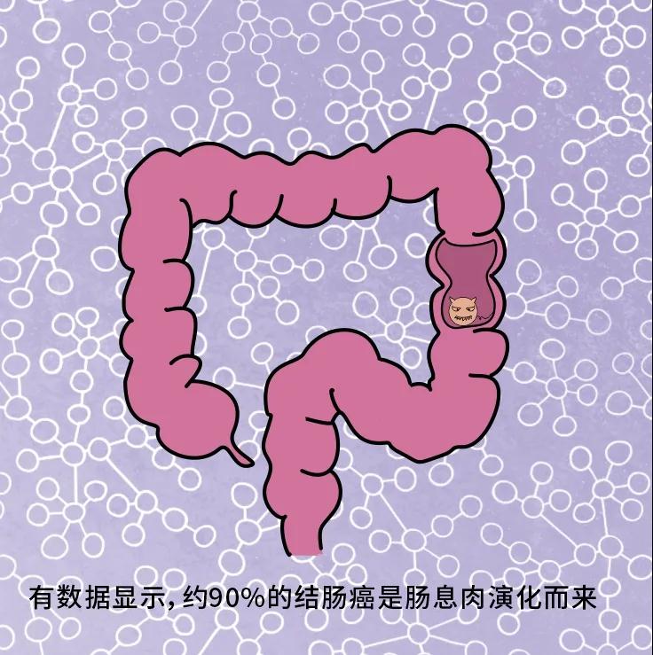 奪走“黑豹”生命的結(jié)腸癌，到底什么來頭？