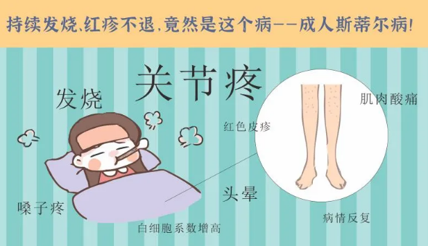 持續(xù)發(fā)燒、紅疹不退……她終于在這里治好了這個罕見病