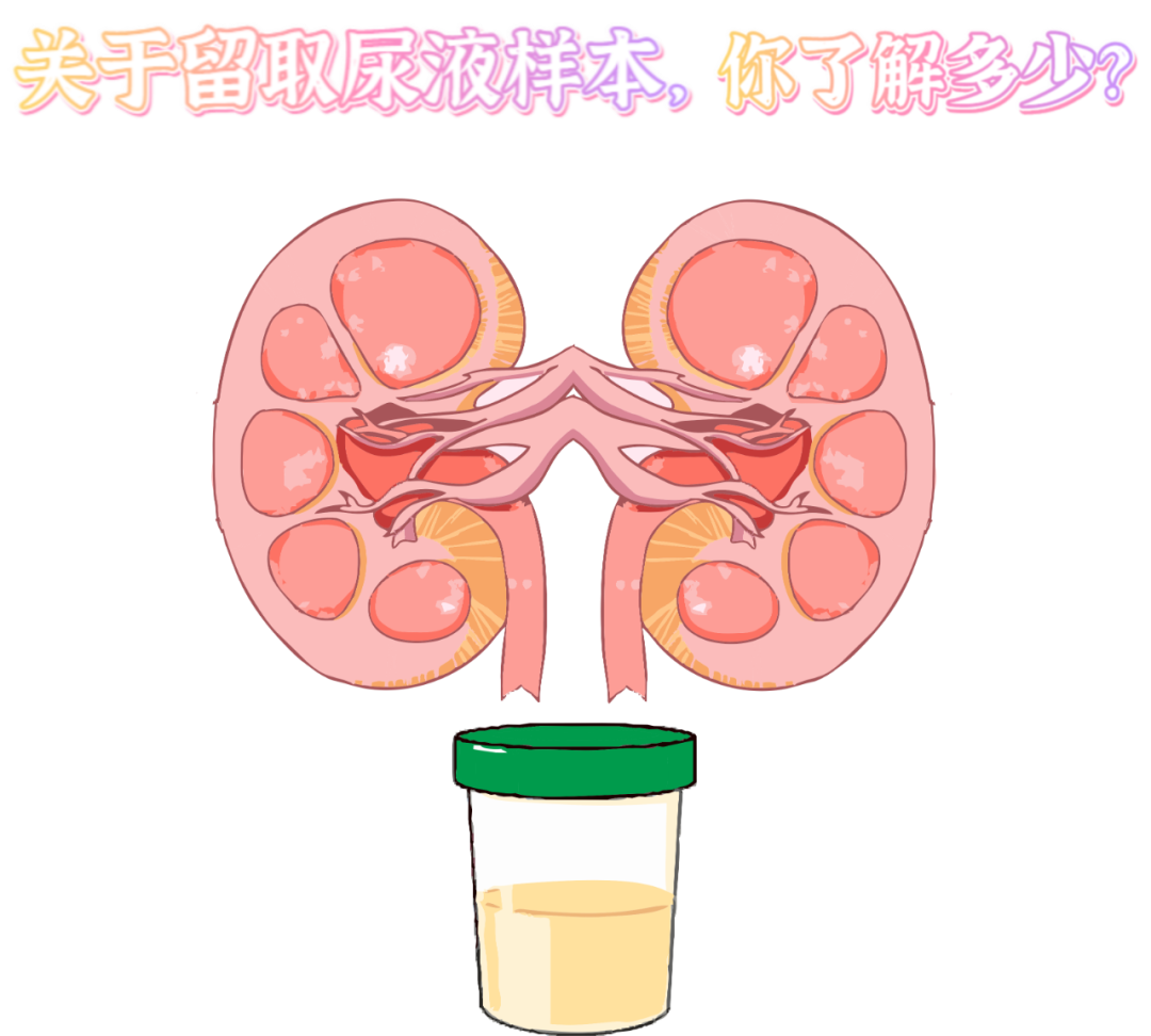 做尿檢，不得不說的注意事項！