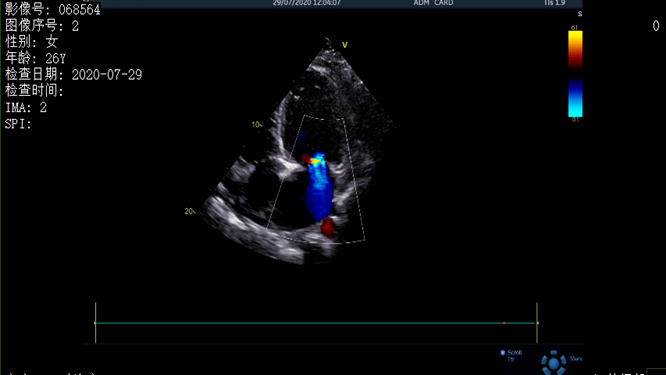 心電圖異常，心臟卻沒事，罪魁禍?zhǔn)资恰?>
				             </a>
                <div   id=