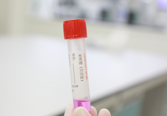 支原體感染檢測手段知多少？