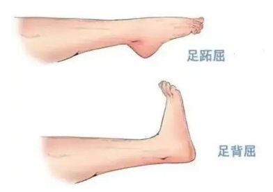 扭胯小連步、動感搖花手……“科目三”雖火，運(yùn)動損傷也要防！