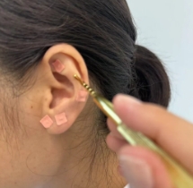 中醫(yī)護(hù)眼 點(diǎn)亮“睛”彩世界！又一波福利來(lái)襲