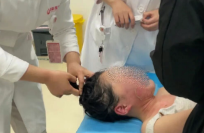 14歲，面、頸、胸燙傷，只因中午那鍋面湯…